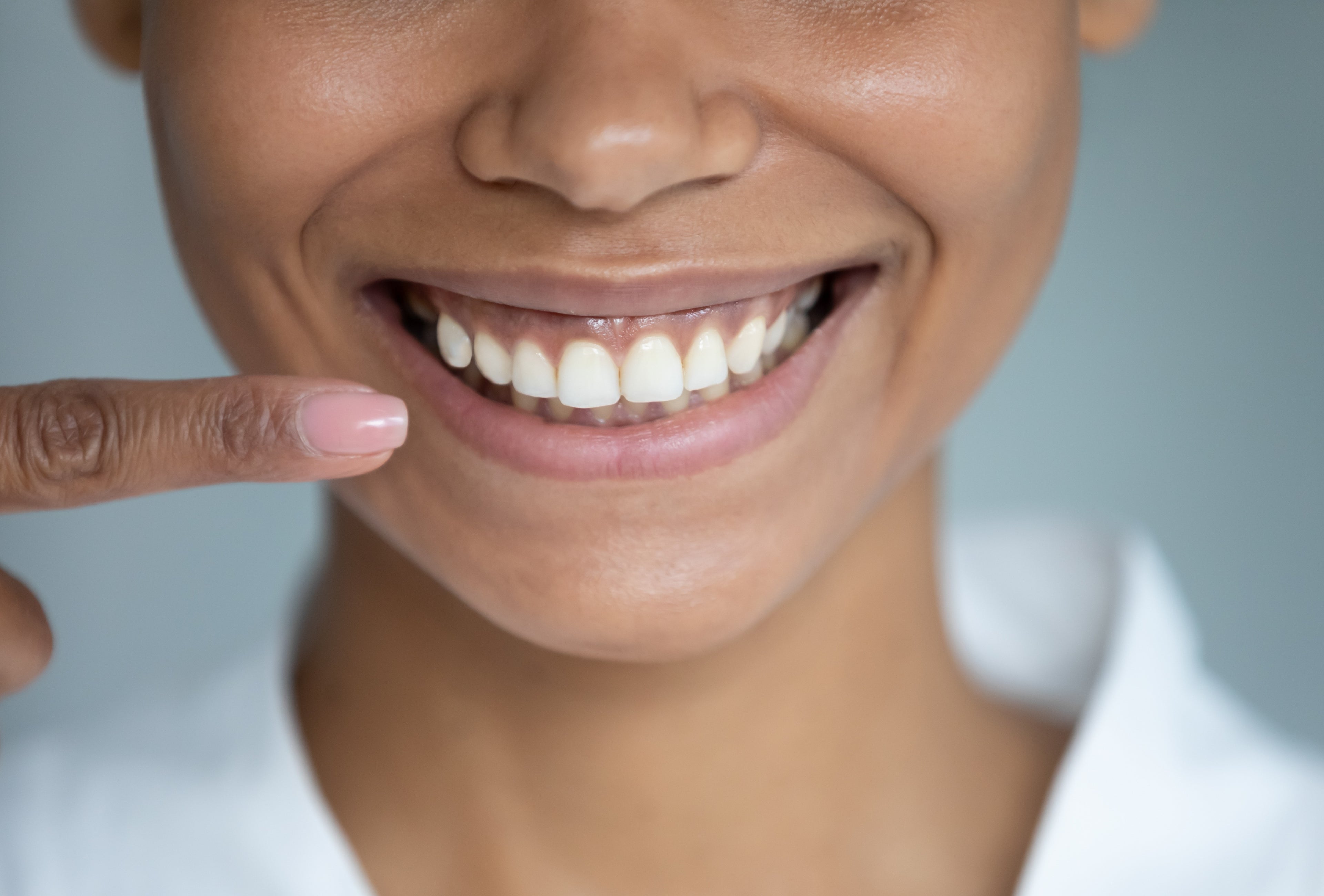 Gingivales Lächeln