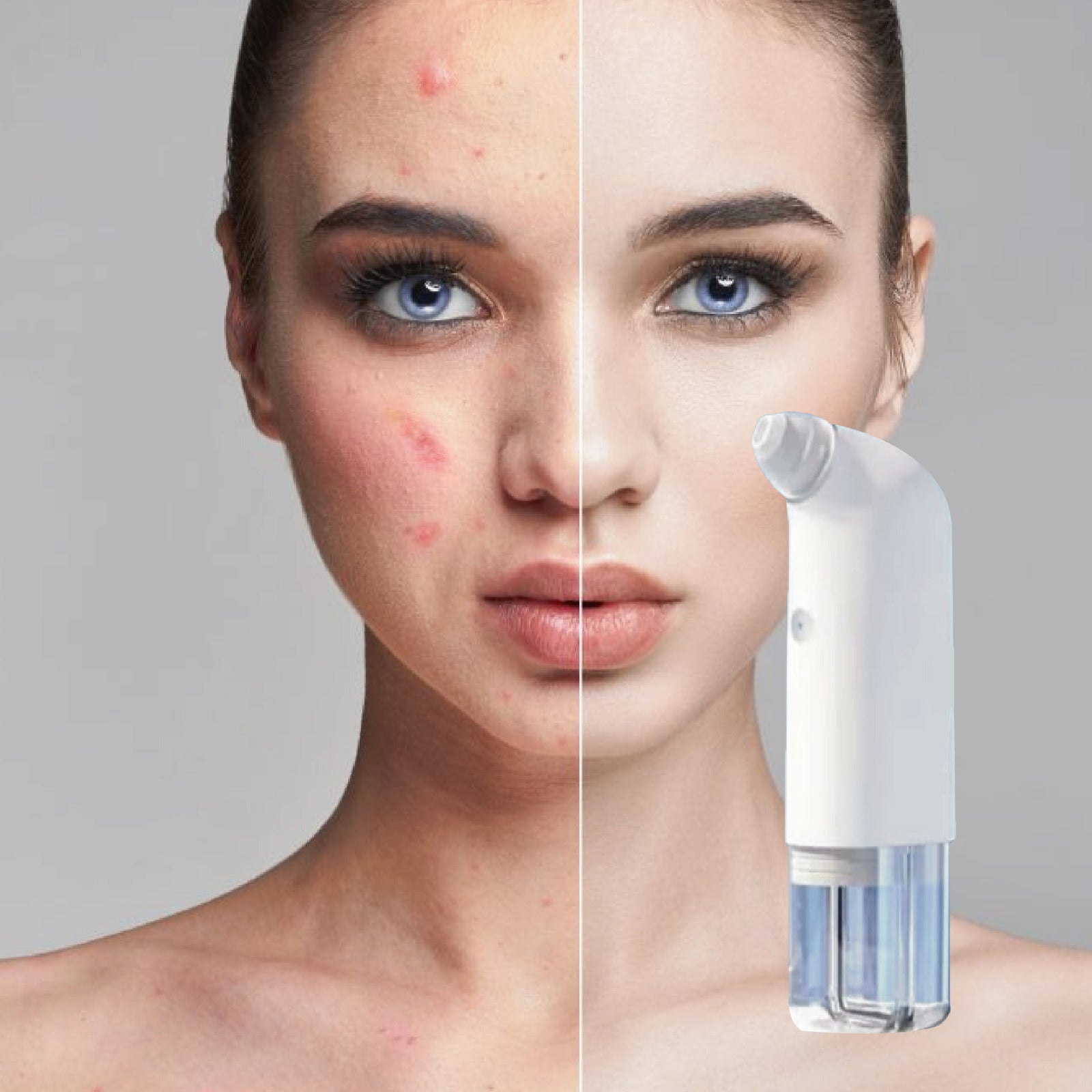 Face cleansing device HidraPlus GAIA