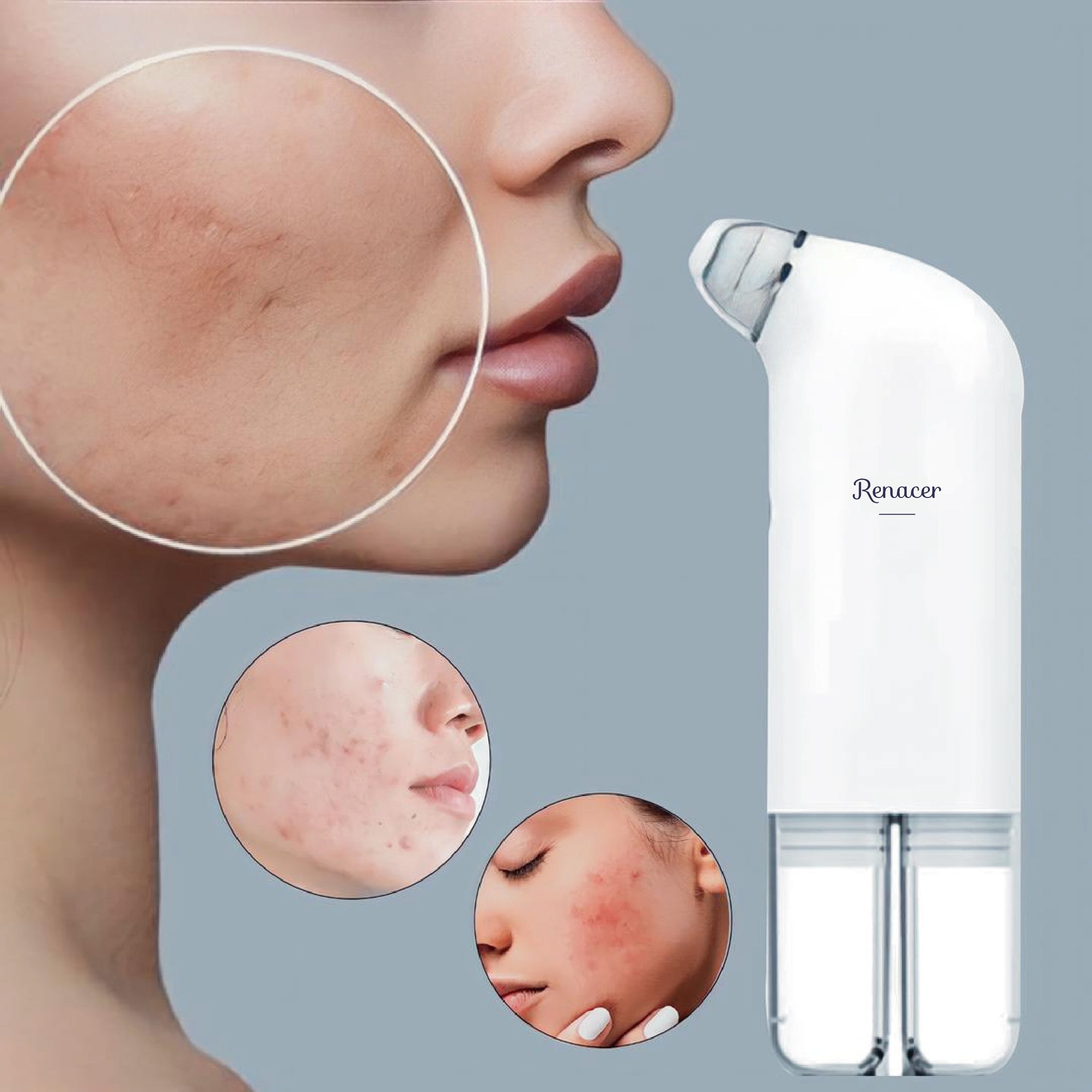 Face cleansing device HidraPlus GAIA