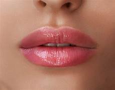 Lippenauffüllung