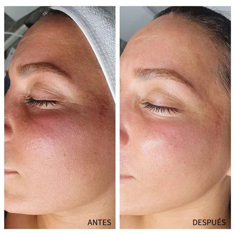 Face cleansing device HidraPlus GAIA